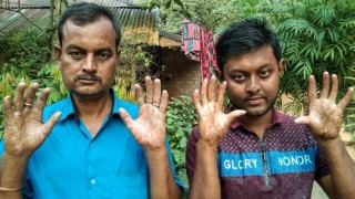 एउटा यस्तो बाङ्ग्लादेशी परिवार जहाँ सबै पुरुष सदस्यका औँलामा कुनै छाप छैन