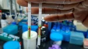 कोरोना सङ्क्रमण परीक्षणको नयाँ विधि