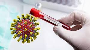 सङ्क्रमण निको हुने दर ७५.१ प्रतिशत